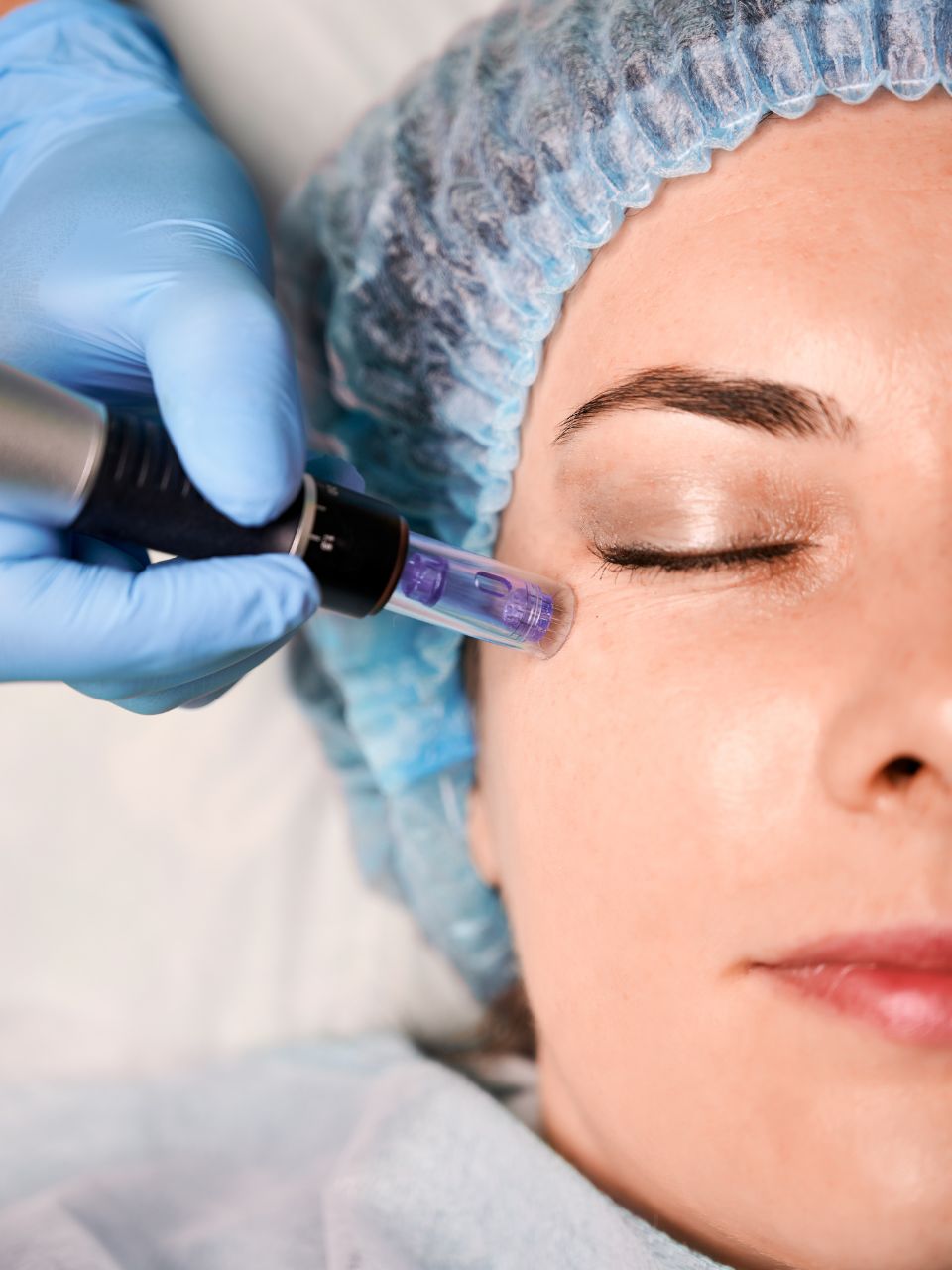 Exosome Collagen Boost Microneedling Facial Buckhead