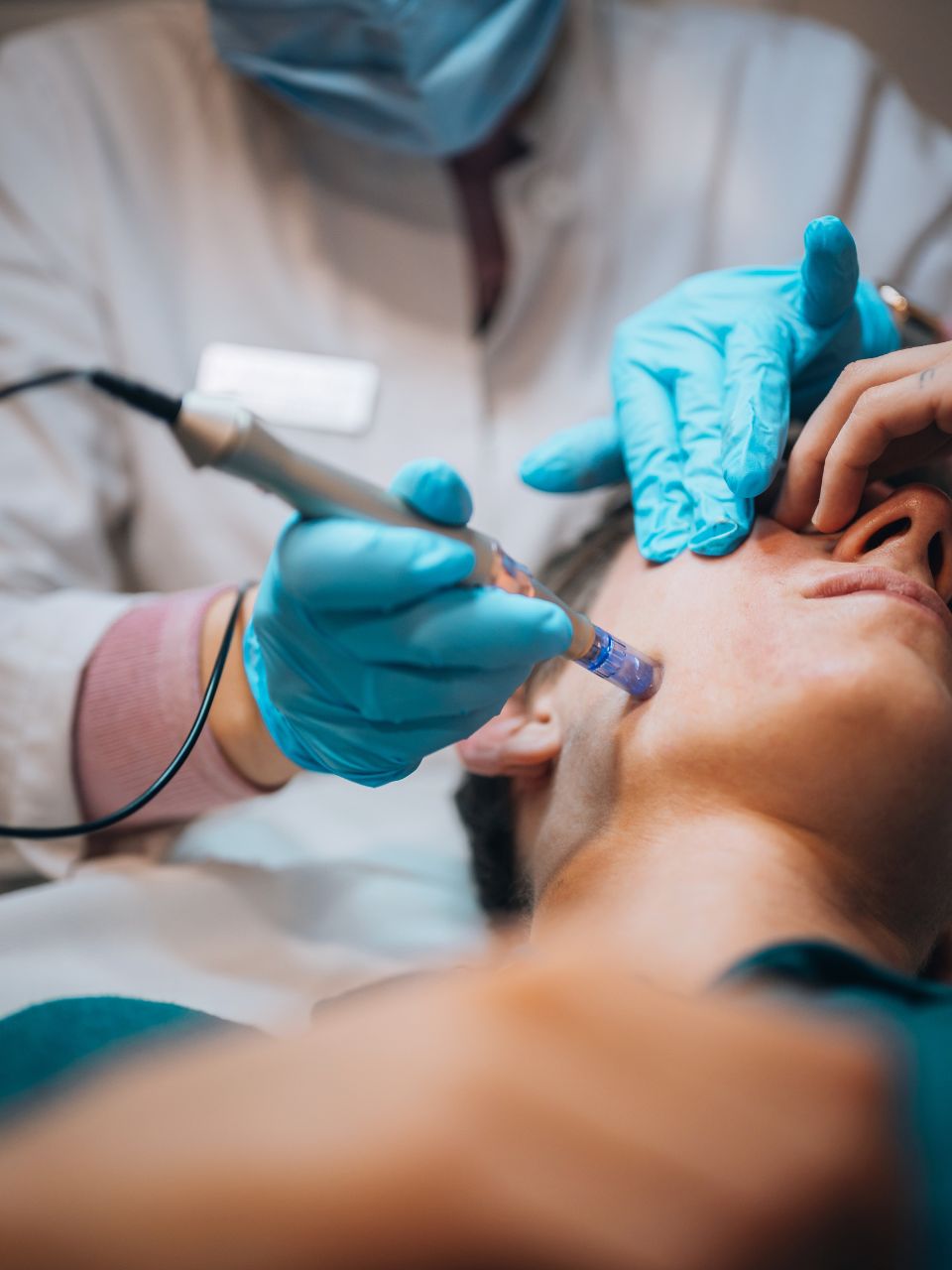 PRP Microneedling Buckhead