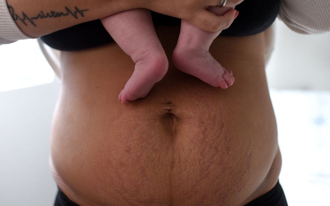 Postpartum Body Confidence: How MedSpa Treatments Can Help You Feel Like You Again